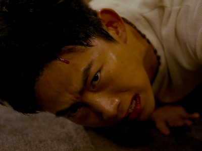 Johan is injured during the homophobic attack.